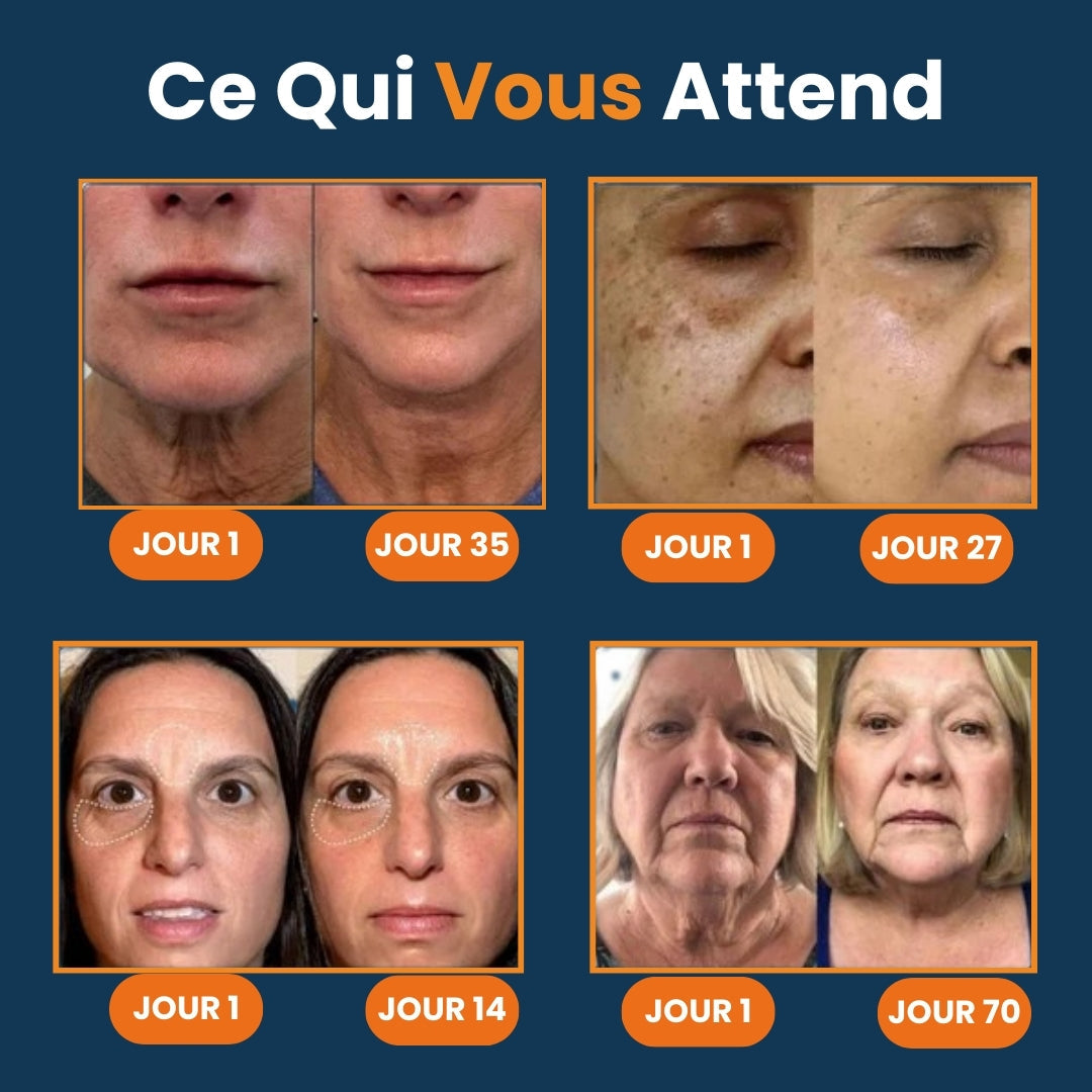 Appareil pour soin visage 