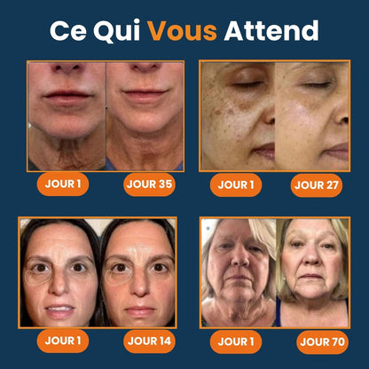 Appareil pour soin visage 